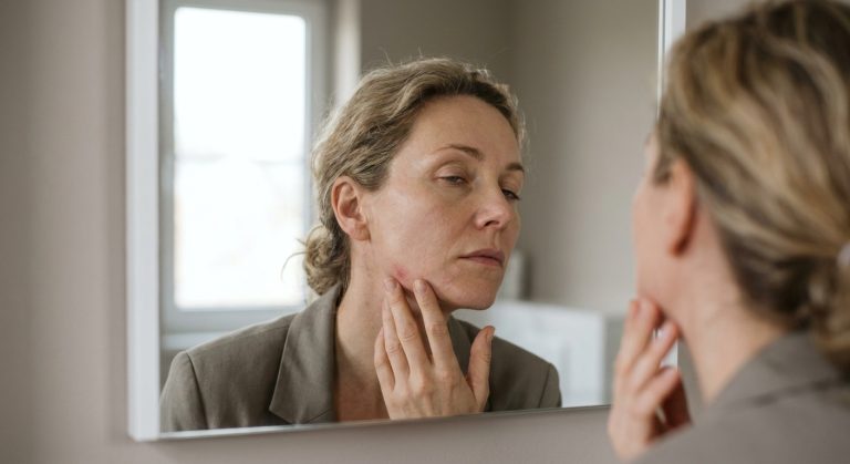 Acné adulte et stress : pourquoi votre peau réagit à votre charge mentale